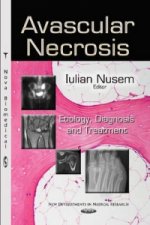 Avascular Necrosis