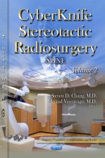 CyberKnife Radiosurgery