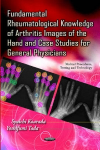 Fundamental Rheumatological Knowledge of Arthritis Images of the Hand & Case Studies for General Physicians