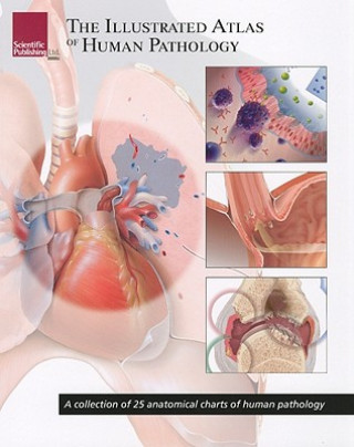 Illustrated Atlas of Human Pathology