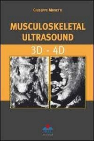 Musculoskeletal Ultrasound 3D - 4D