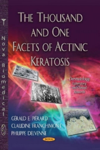 Thousand & One Facets of Actinic Keratosis