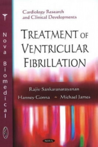 Treatment of Ventricular Fibrillation