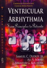 Ventricular Arrhythmia