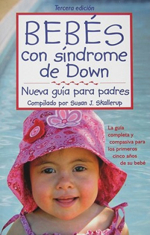 Bebes con sindrome de Down