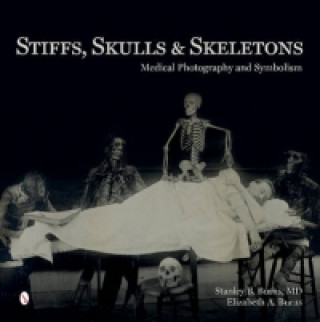 Stiffs, Skulls and Skeletons
