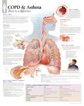 COPD & Asthma Laminated Poster