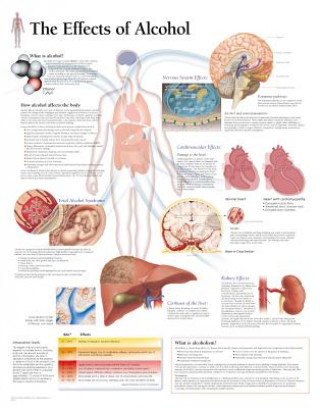 Effects of Alcohol Paper Poster