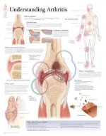 Understanding Arthritis Paper Poster