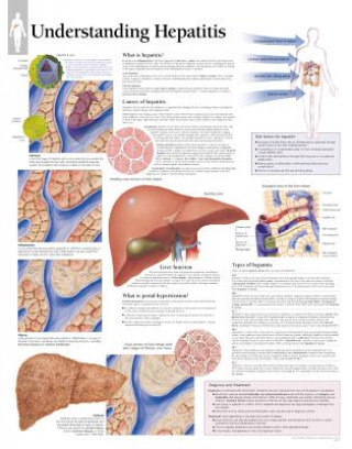 Understanding Hepatitis Paper Poster