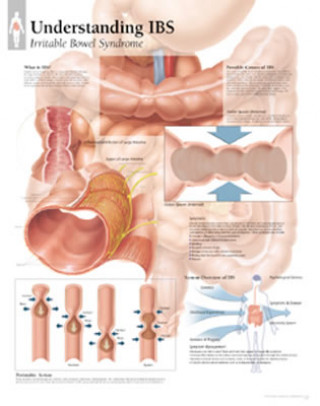 Understanding IBS Paper Poster