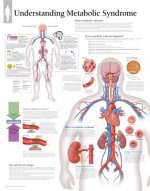 Understanding Metabolic Syndrome Laminated Poster