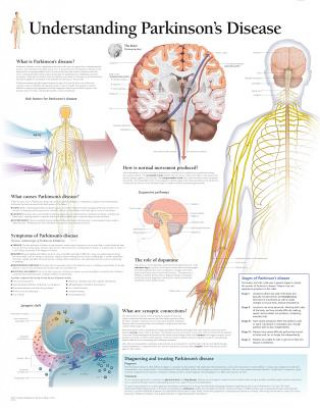 Understanding Parkinson's Laminated Poster