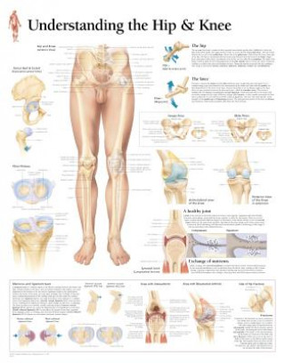 Understanding the Hip & Knee Laminated Poster