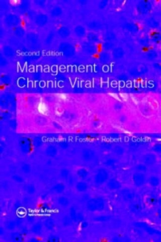 Management of Chronic Viral Hepatitis, Second Edition