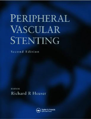 Peripheral Vascular Stenting, Second Edition