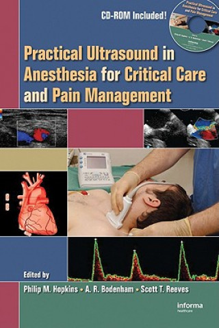 Practical Ultrasound in Anesthesia for Critical Care and Pain Management