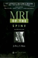 MRI of the Spine