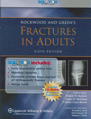 Rockwood Fractures