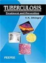 Tuberculosis