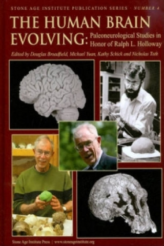 Human Brain Evolving