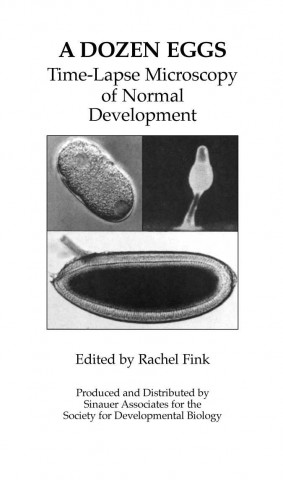 Dozen Eggs: Time Lapse Microscopy of Normal Development