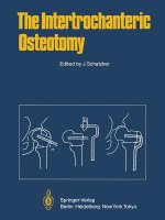 Intertrochanteric Osteotomy