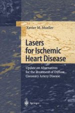 Lasers for Ischemic Heart Disease