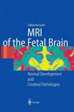 MRI of the Fetal Brain