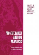 Prostate Cancer and Bone Metastasis