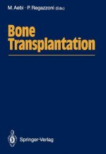 Bone Transplantation