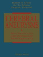 Cerebral Aneurysms