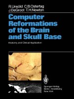 Computer Reformations of the Brain and Skull Base