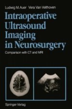Intraoperative Ultrasound Imaging in Neurosurgery