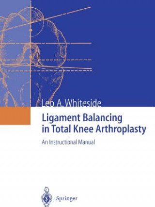 Ligament Balancing in Total Knee Arthroplasty