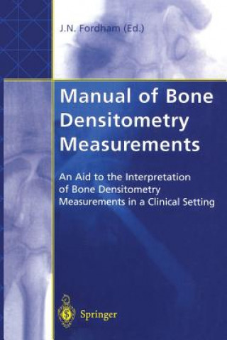 Manual of Bone Densitometry Measurements (John N. Fordham)(Brožovaná)