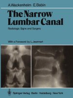 Narrow Lumbar Canal