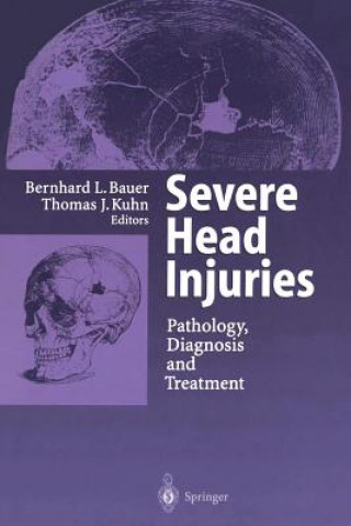 Severe Head Injuries