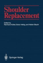 Shoulder Replacement