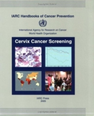 Cervix Cancer Screening