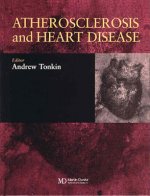 Atherosclerosis and Heart Disease
