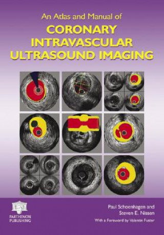 Atlas and Manual of Coronary Intravascular Ultrasound Imaging