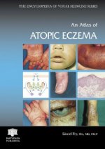 Atlas of Atopic Eczema