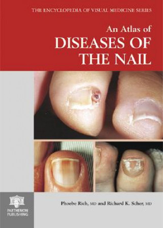 Atlas of Diseases of the Nail