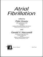 Atrial Fibrillation