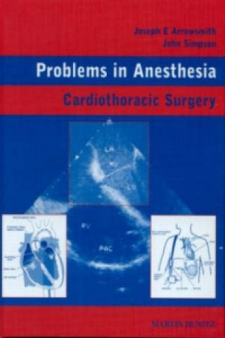 Cardiothoracic Surgery