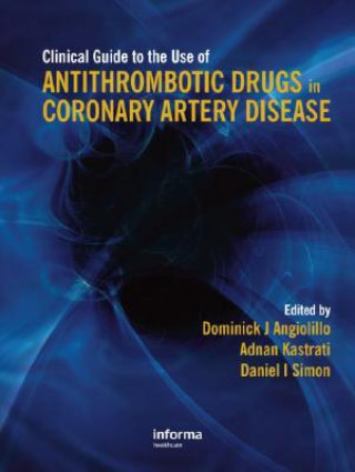 Clinical Guide to the Use of Antithrombotic Drugs in Coronary Artery Disease