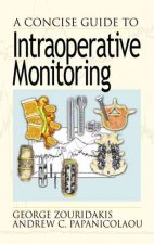 Concise Guide to Intraoperative Monitoring