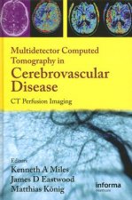Multidetector Computed Tomography in Cerebrovascular Disease