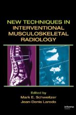 New Techniques in Interventional Musculoskeletal Radiology